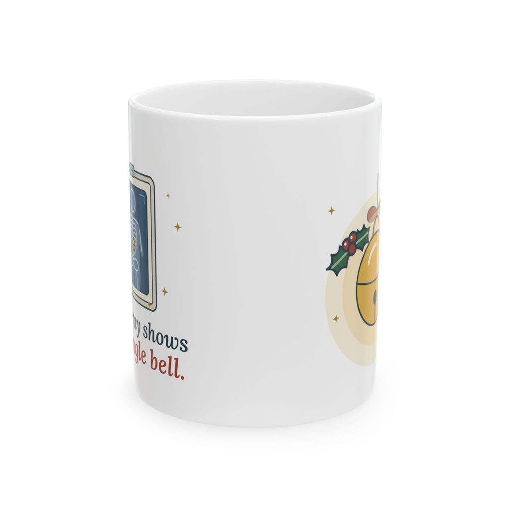 Peds ER Christmas Coffee Mug - The X-Ray Shows One Jingle Bell. Rad Tech Gift Mug